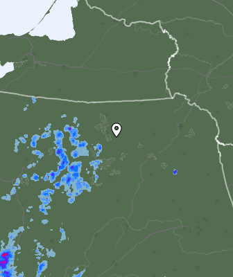 Radar