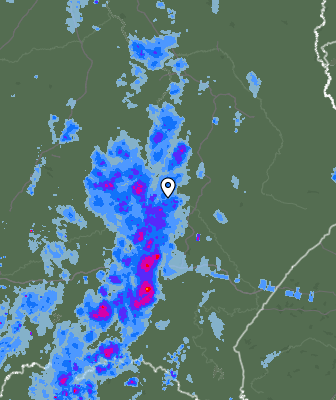 Radar