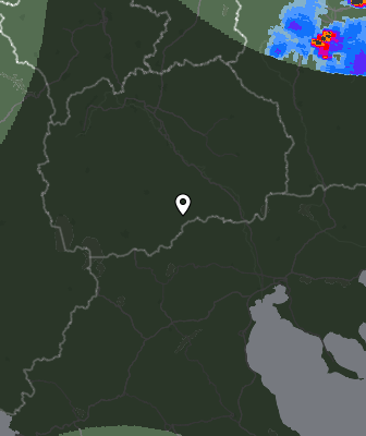 Radar