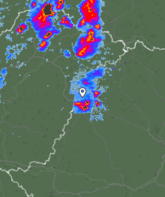Radar