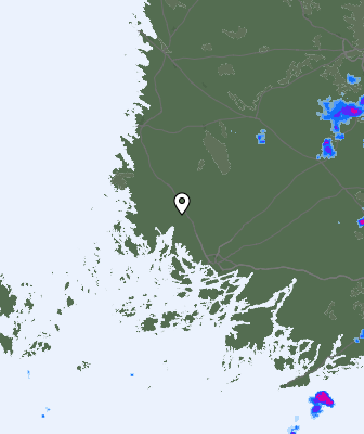Radar