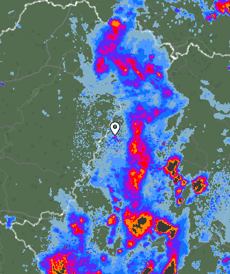 Radar
