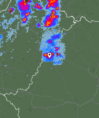Radar