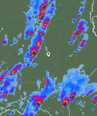 Radar