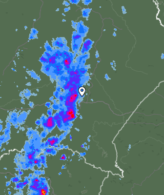 Radar