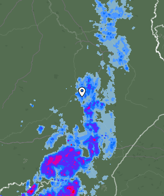 Radar