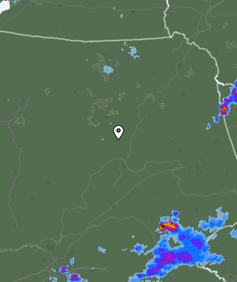 Radar
