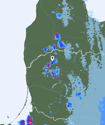 Radar