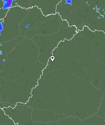 Radar