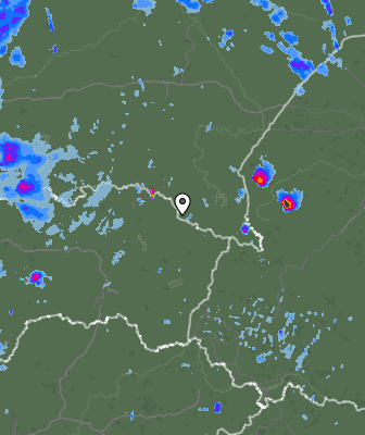 Radar