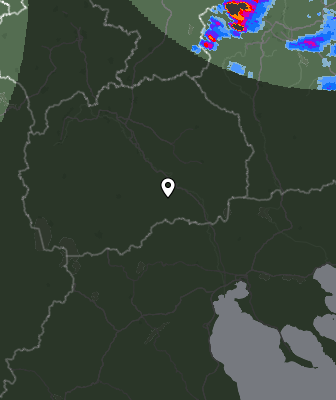 Radar
