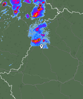 Radar