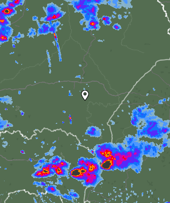 Radar