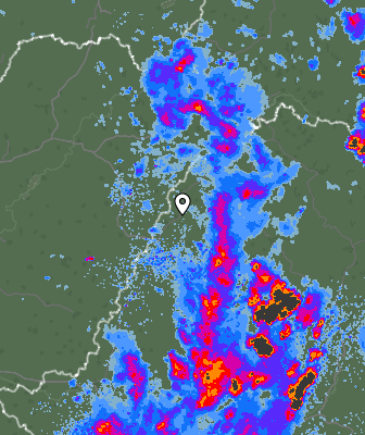 Radar
