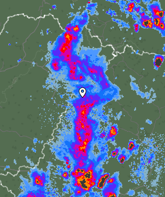 Radar