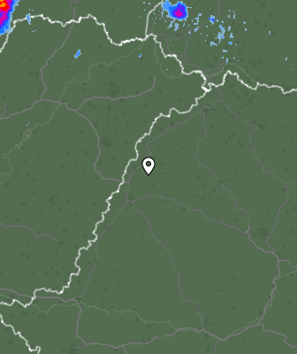 Radar