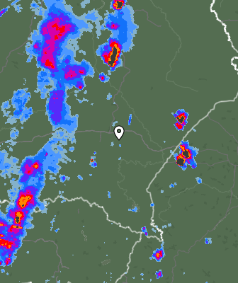 Radar