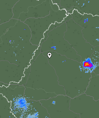 Radar