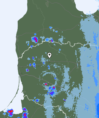 Radar