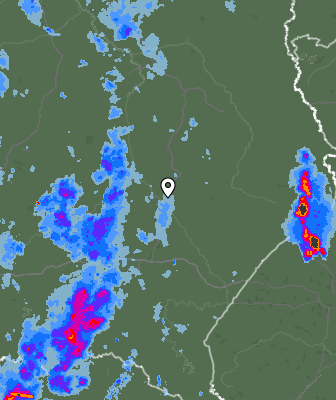Radar
