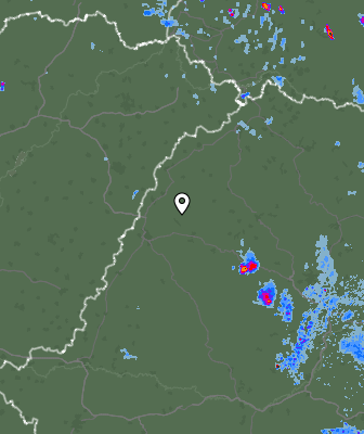 Radar