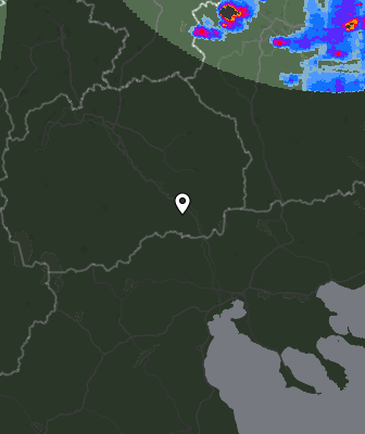 Radar