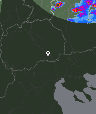 Radar