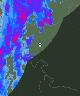 Radar