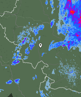 Radar