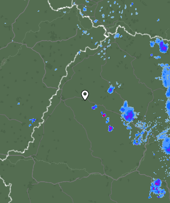 Radar