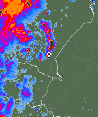 Radar