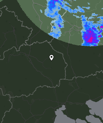 Radar