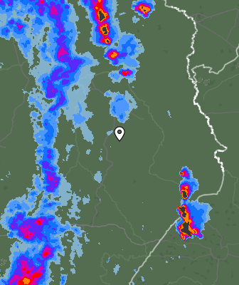Radar