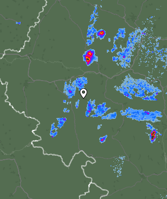 Radar