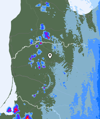 Radar
