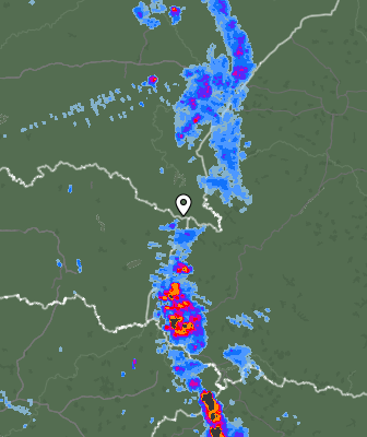 Radar