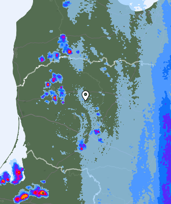 Radar