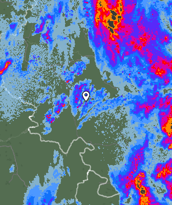 Radar