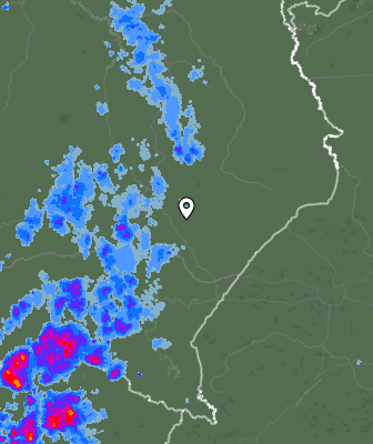 Radar
