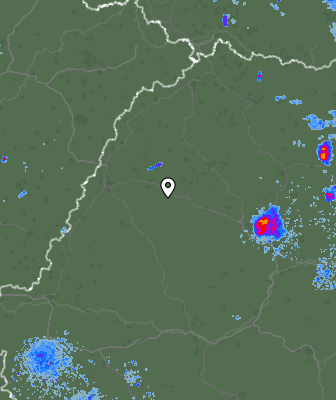 Radar