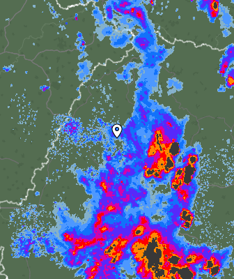 Radar