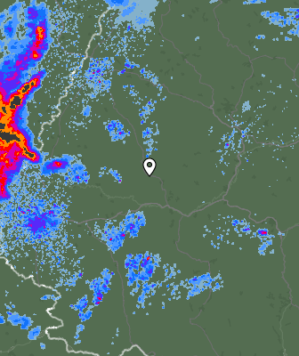 Radar