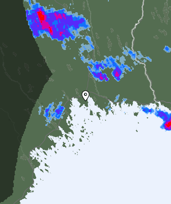 Radar