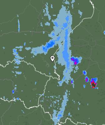 Radar