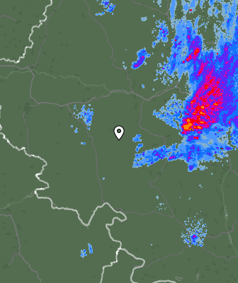 Radar