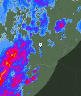 Radar