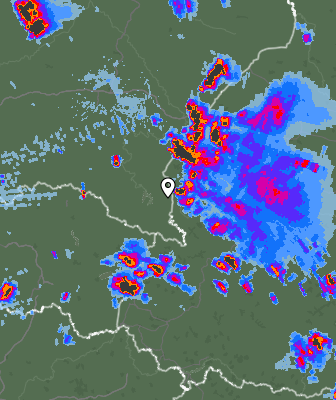 Radar