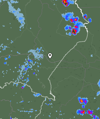 Radar