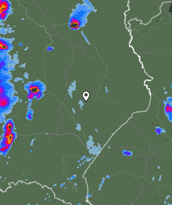Radar