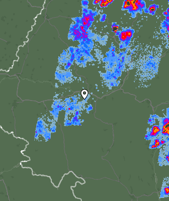 Radar